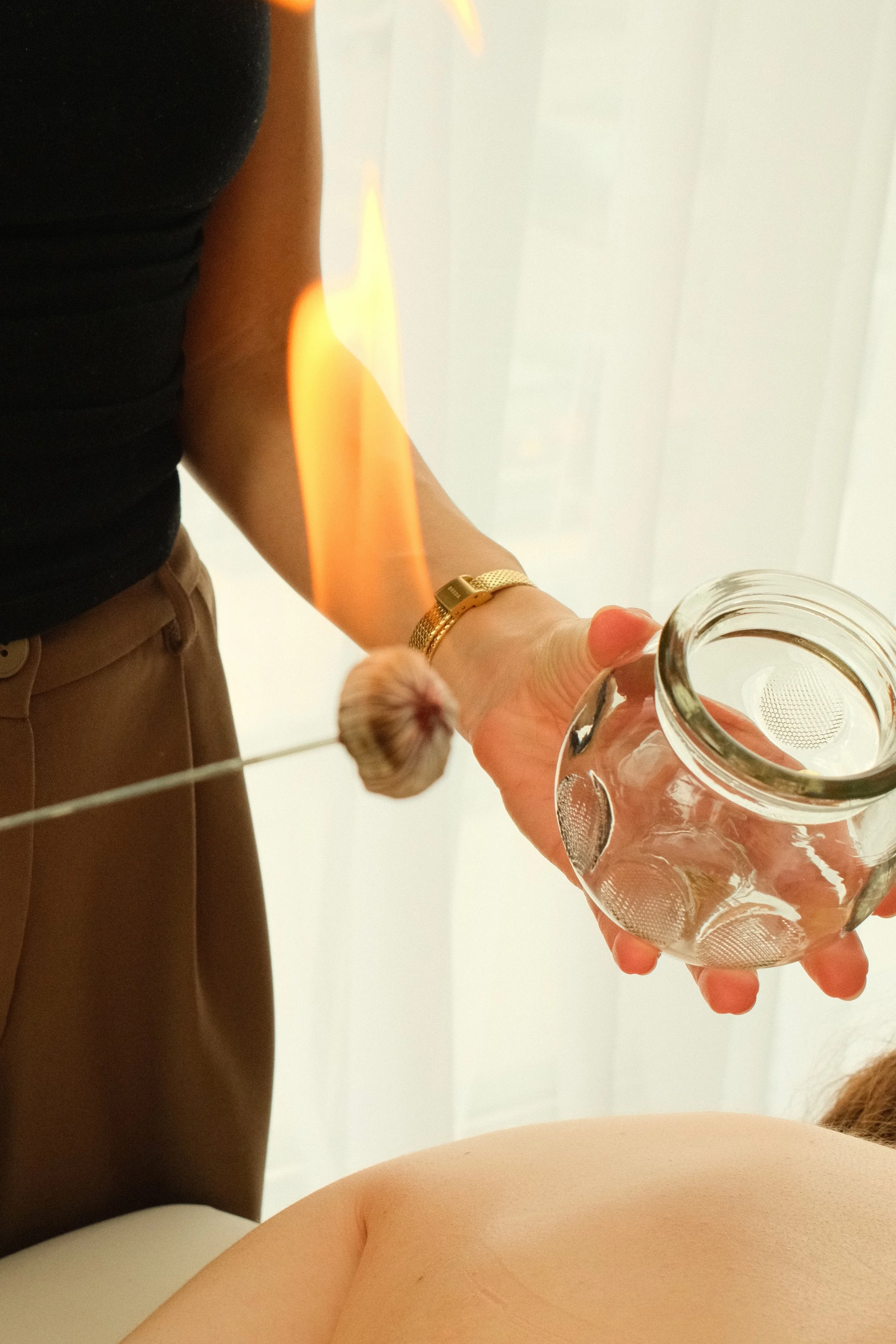 fire cupping acupuncture treatment 