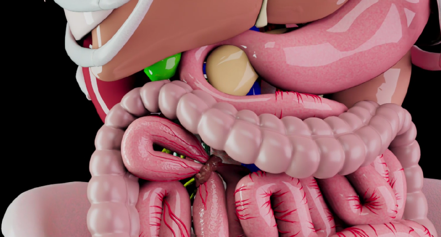 Frame from IQorb's 3D animation of bowel ischemia
