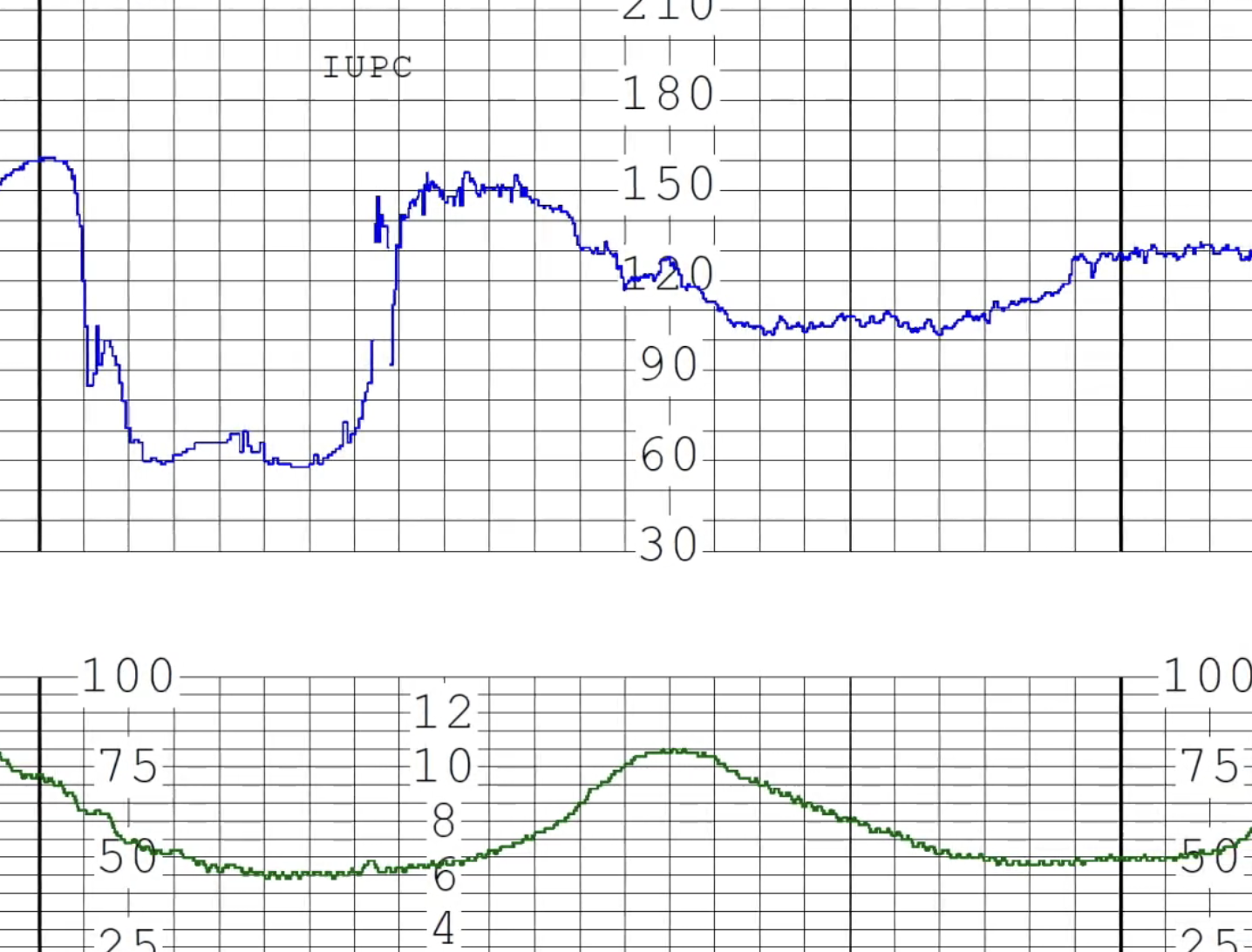A digital representation of a heart rate monitor with a blue electrocardiogram line on a dark blue background.