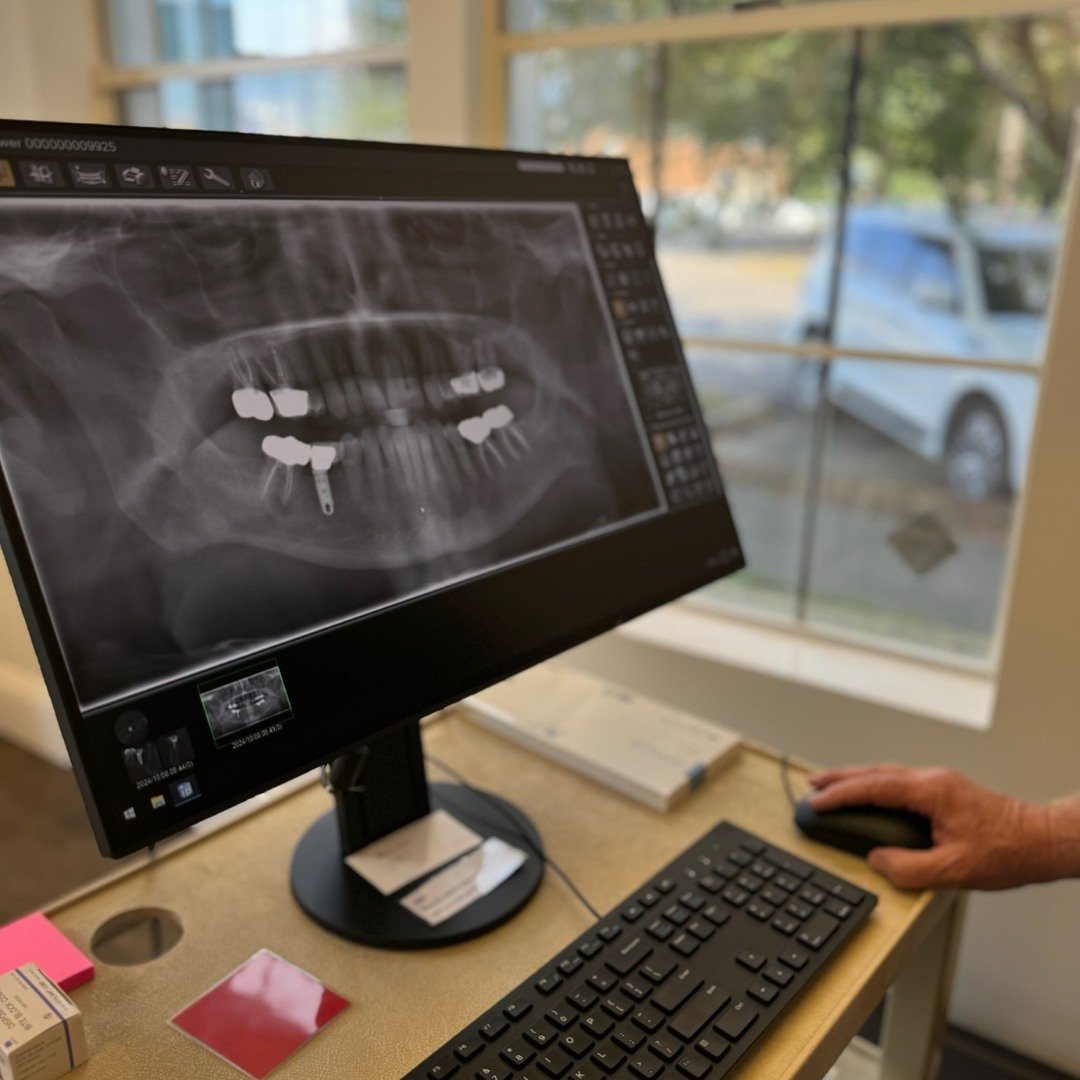 Our commitment to our patients and referring doctors is to strive to provide the best root canal treatment possible.
ㅤ
Part of giving you that&rdquo;best&rdquo; is having technology that helps us do just that.
We recently installed &ldquo;the latest 