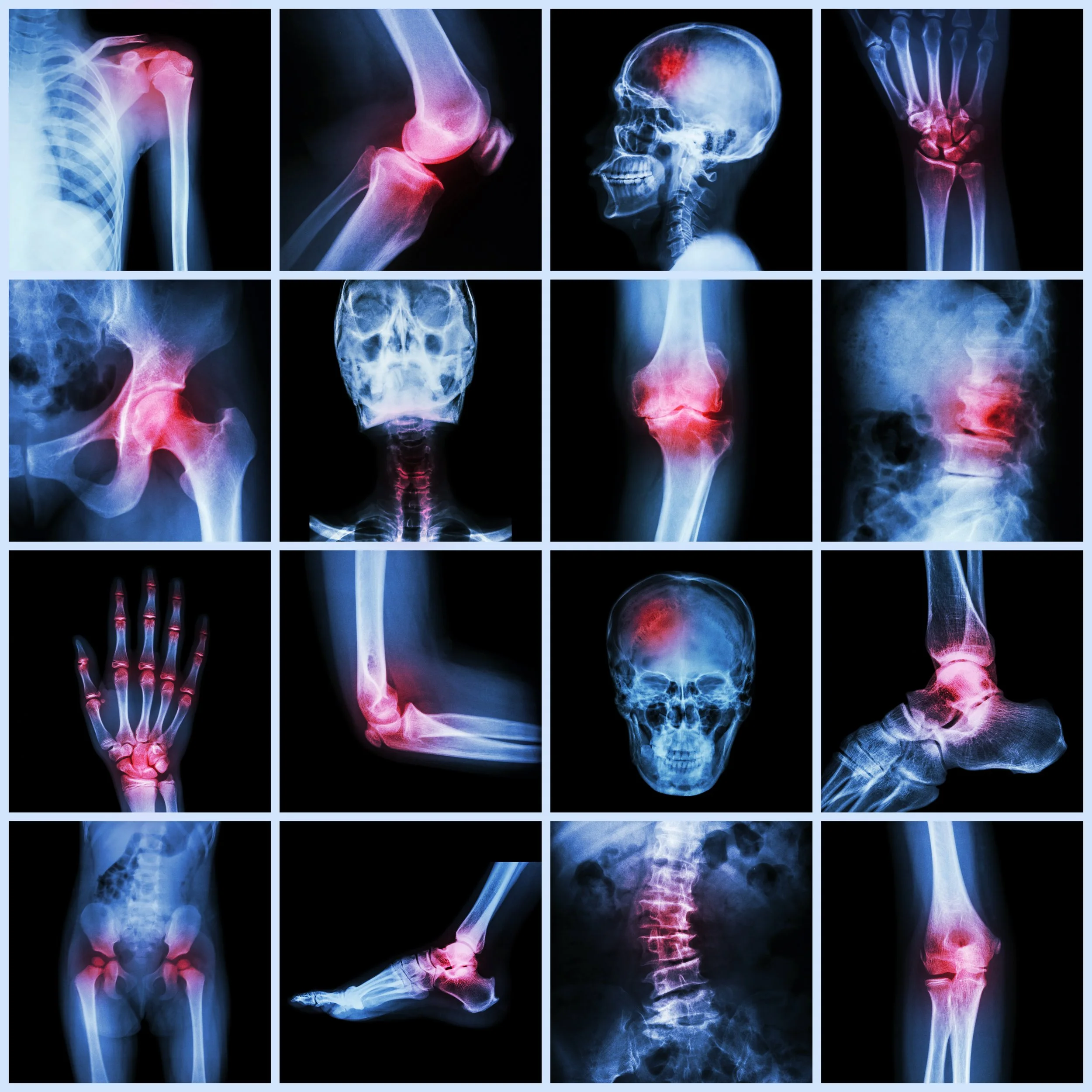 vecteezy_collection-of-human-joints-and-arthritis-and-stroke_2842005.jpg
