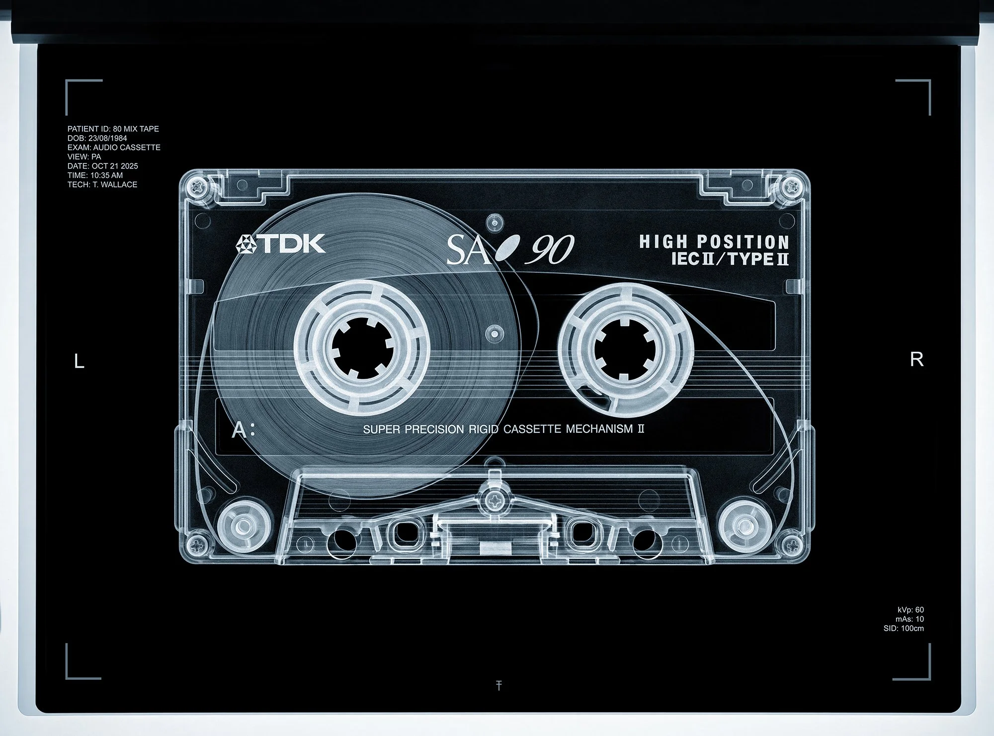 X-Ray of TDK Cassette tape