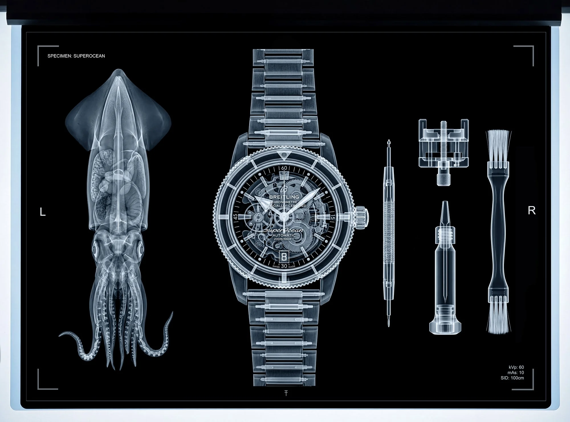 X-ray of watch and squid 
