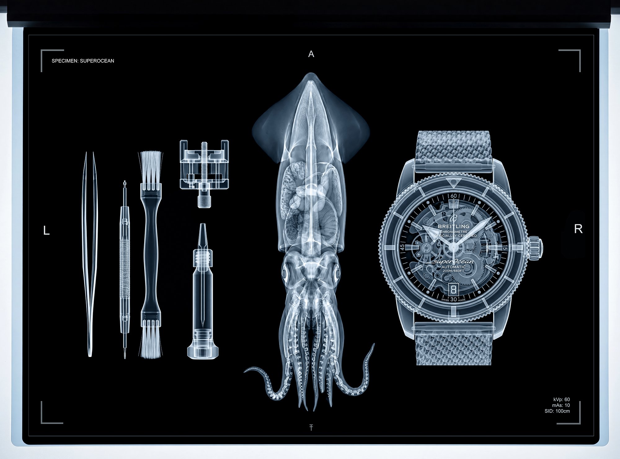 X-Ray of watch with squid