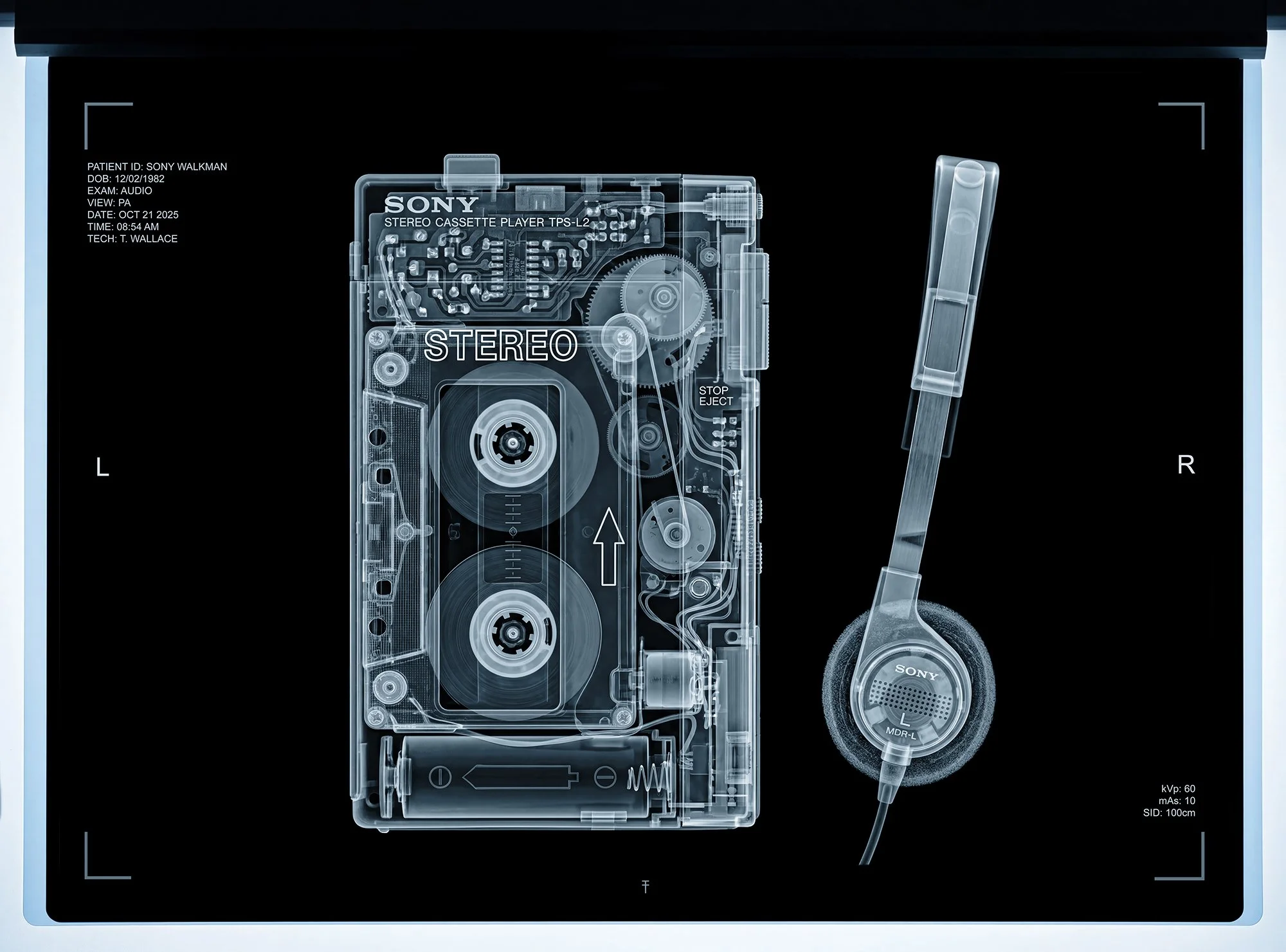 X-Ray of Sony walkman