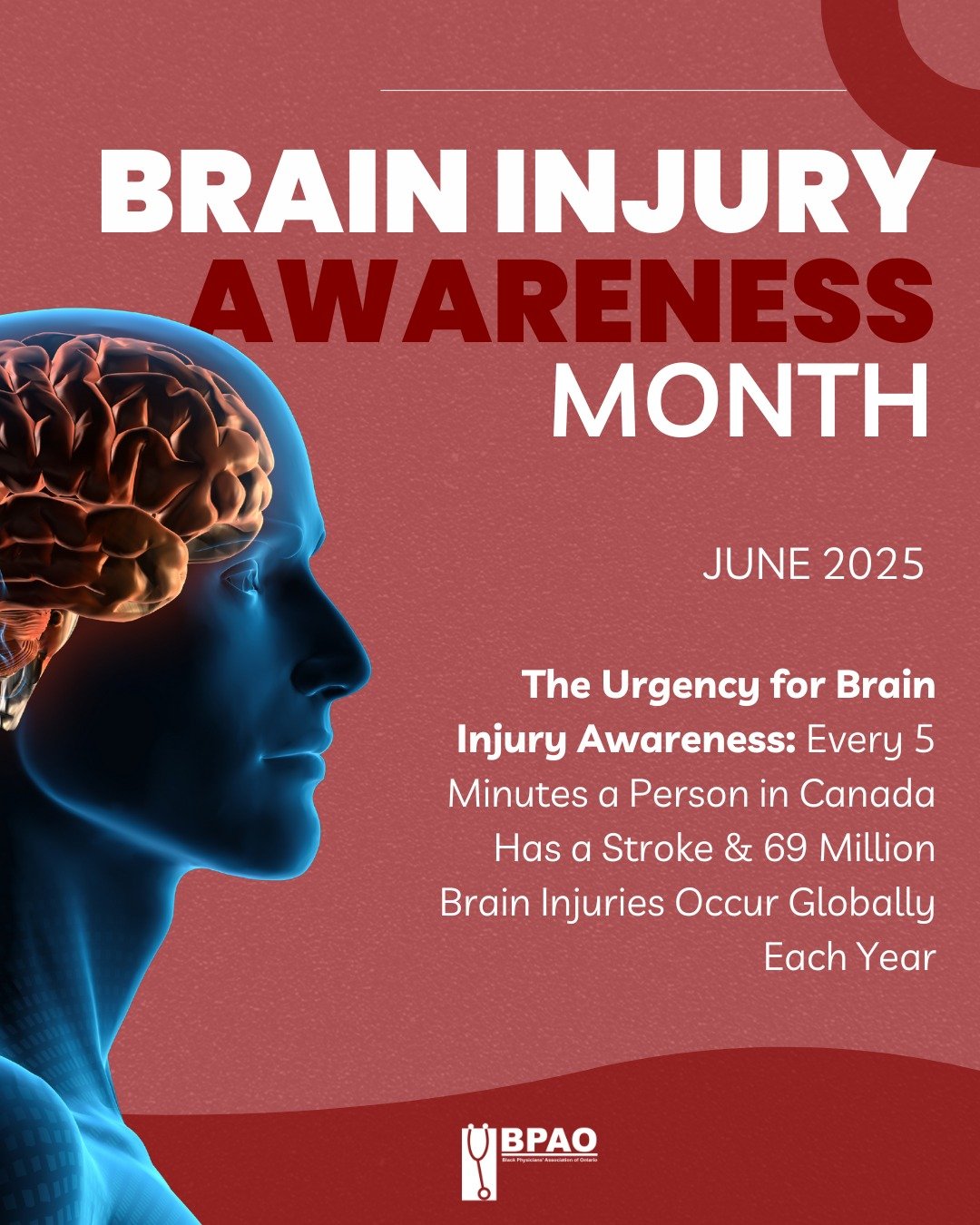 June is #BrainInjuryAwarenessMonth,  a time to spotlight an invisible struggle that affects millions.

Every 5 minutes, someone in Canada has a stroke. Around the world, 69 million people suffer brain injuries each year, yet so many go undiagnosed, m