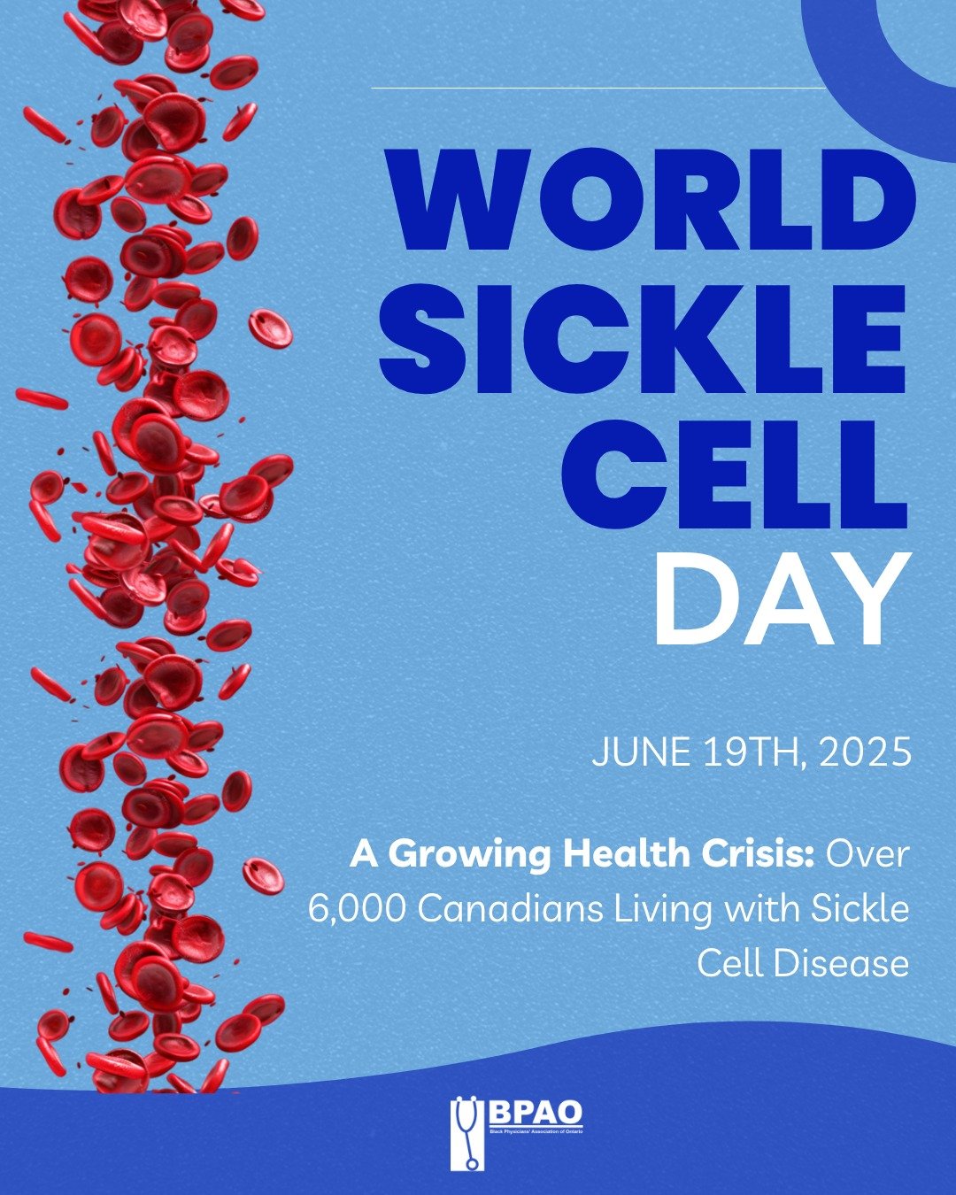 Today, on #WorldSickleCellDay, we&rsquo;re shining a light on a disorder that continues to be misunderstood.

Sickle Cell Disease affects thousands of Canadians, but it&rsquo;s not just a &ldquo;Black disease.&rdquo; It&rsquo;s a serious inherited co