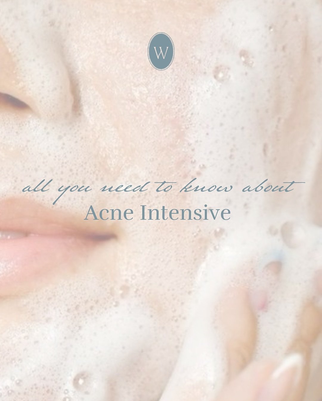 Struggling with persistent acne?
Our targeted Acne Intensive Program uses professional-grade treatments and a personalized plan to deliver real results &mdash; not just cover-ups.
📍DM us or book online for your consultation!

#willowdayspa #evansga 
