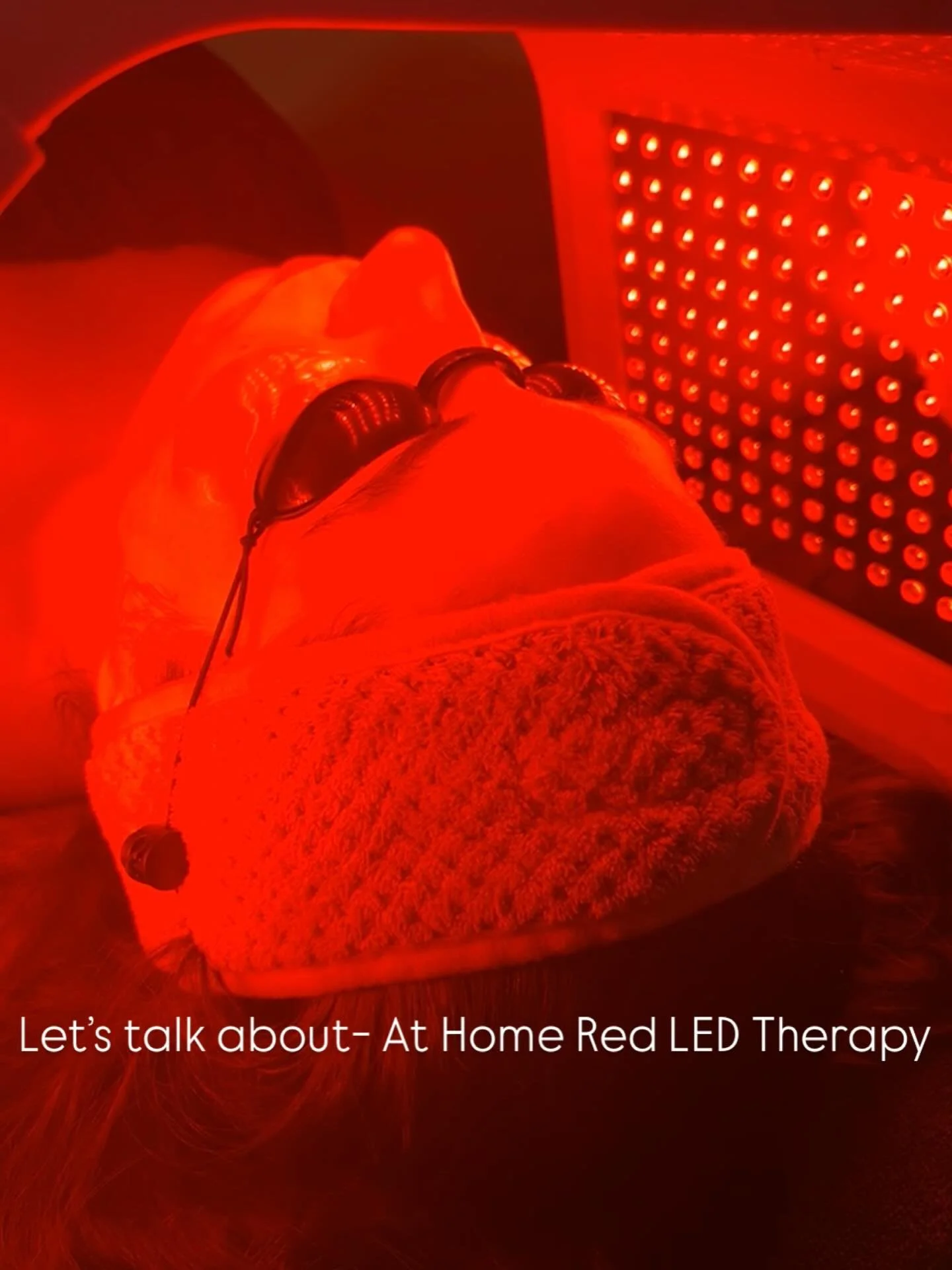 ✨ Is At-Home Red Light Therapy Worth It? Let&rsquo;s Talk! ✨

Red light therapy isn&rsquo;t just a fancy spa trend &mdash; it&rsquo;s backed by science and loved for a reason 💡✨ ⁠ At-home devices can help with: ✔️ Boosting collagen ✔️ Reducing infla