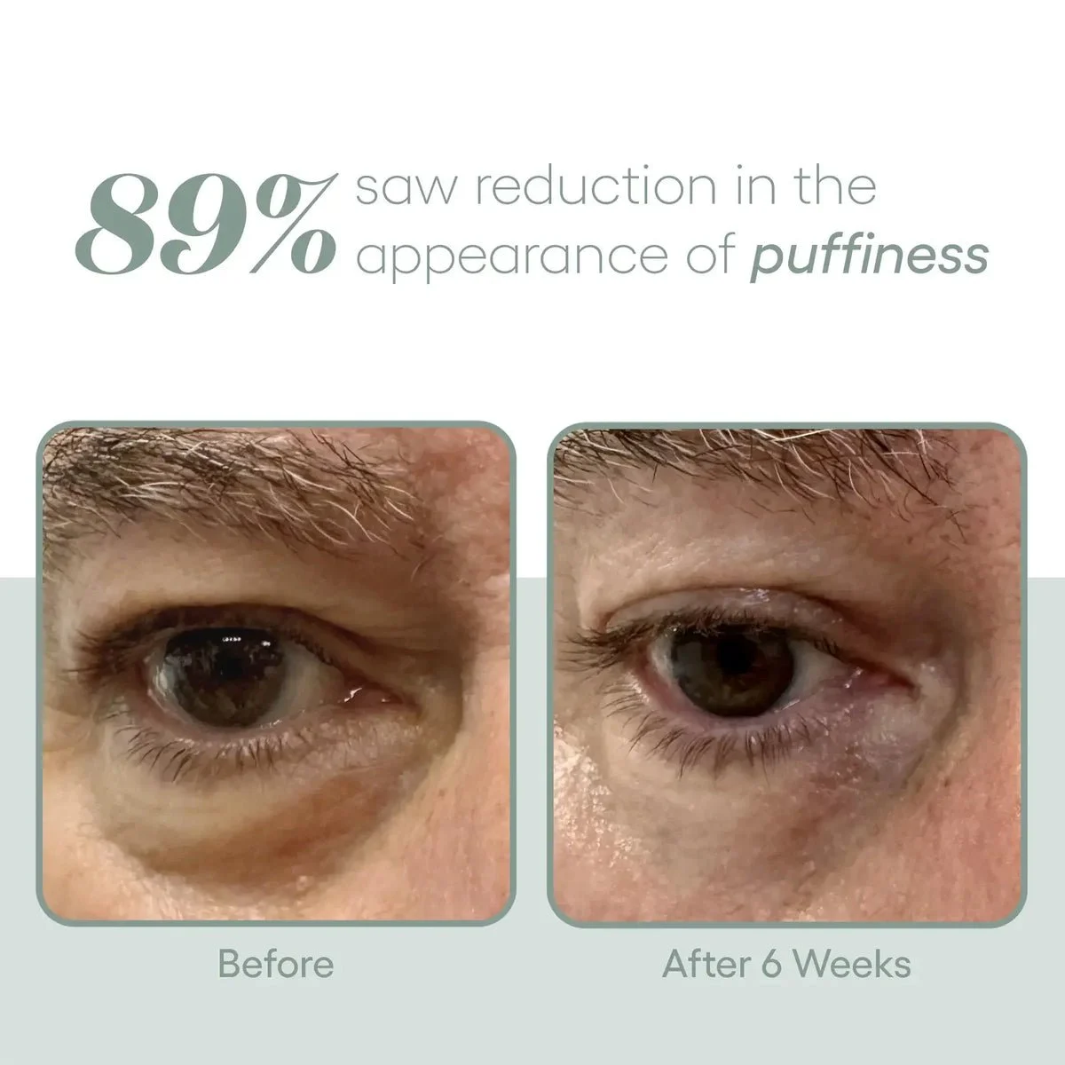 Exosome_EYE_Serum_Plated-3.webp.jpeg