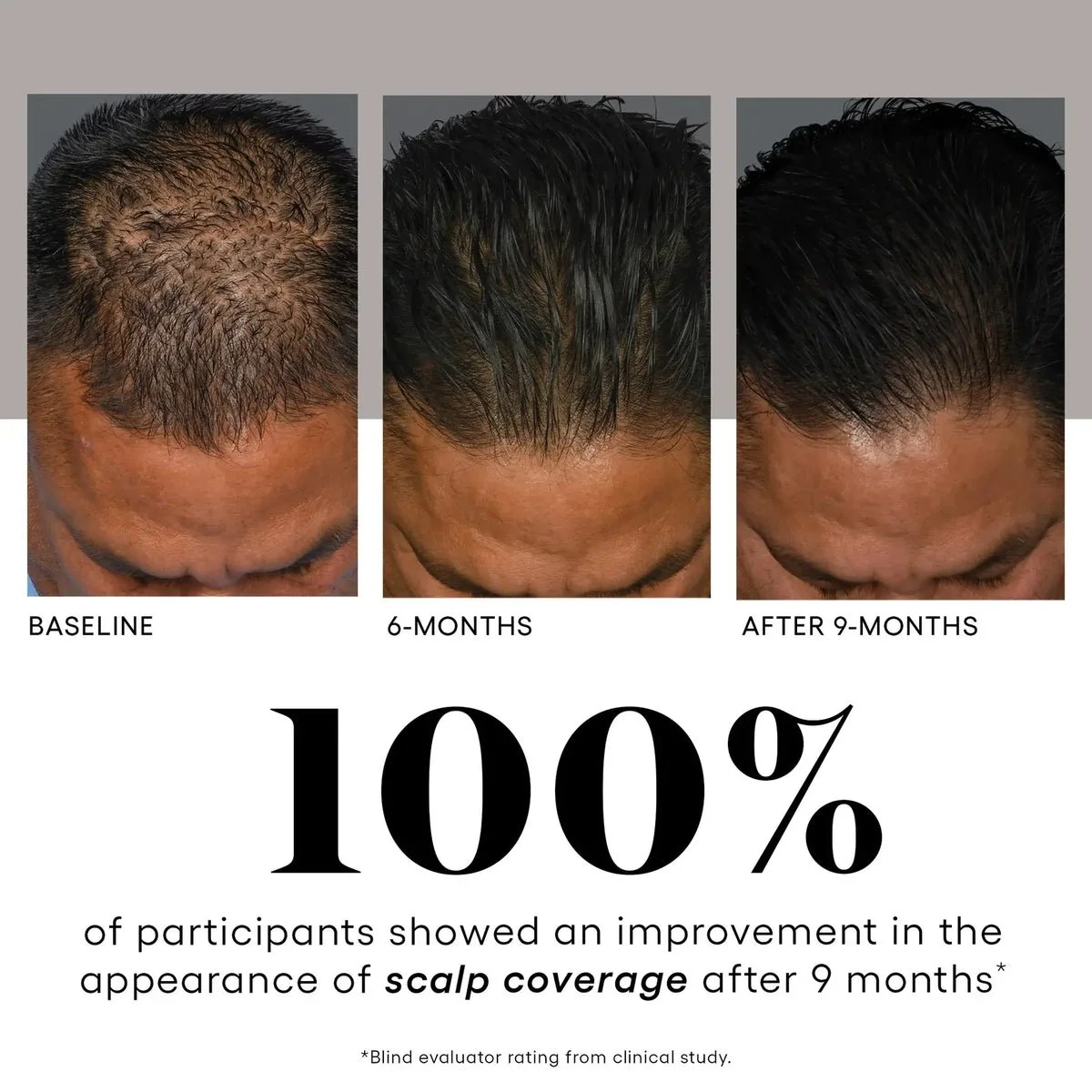 At_Home_Exosomes_for_HAIR_Plated_Hair_Serum-4.webp.jpeg