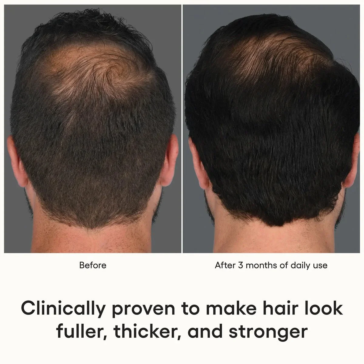 At_Home_Exosomes_for_HAIR_Plated_Hair_Serum-9.webp.jpeg