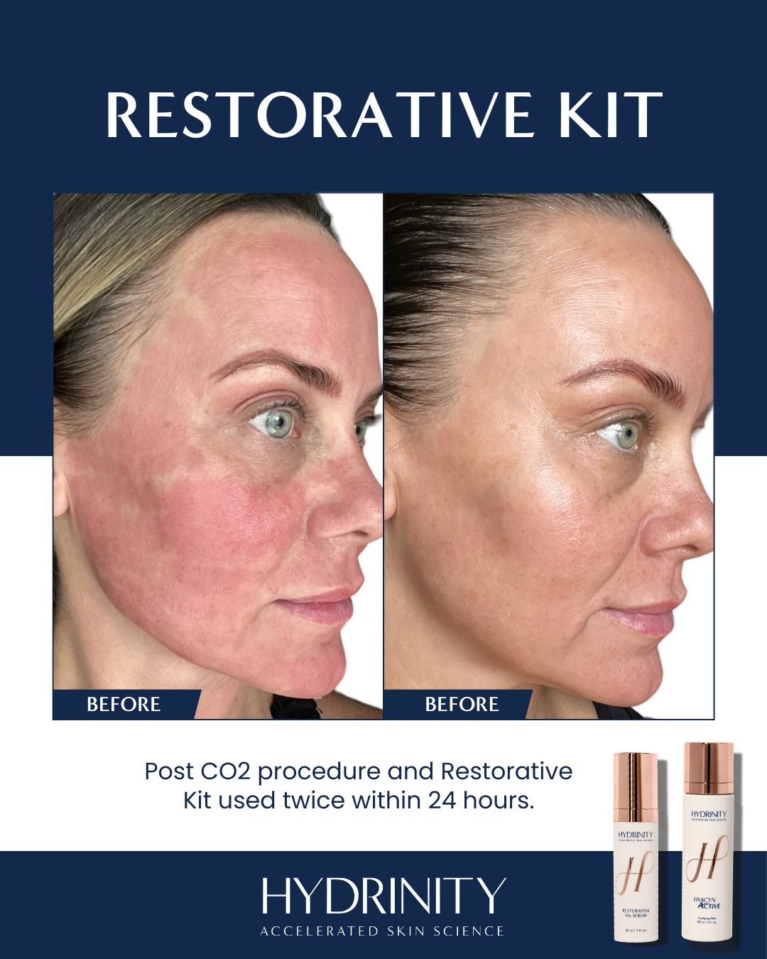 HYDRINITY Feb 2026 Social posts (2).png