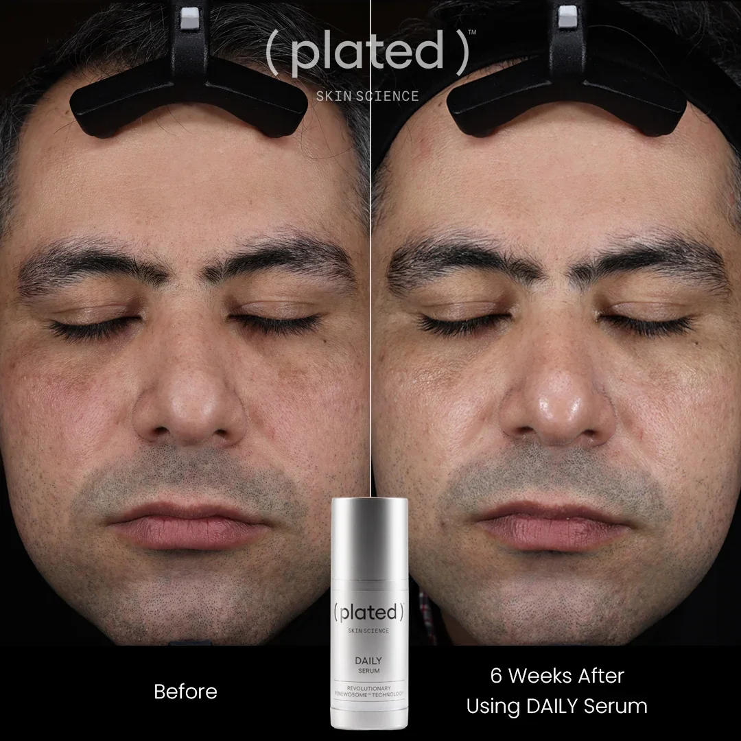 DAILY_Before_After_1.jpg.webp