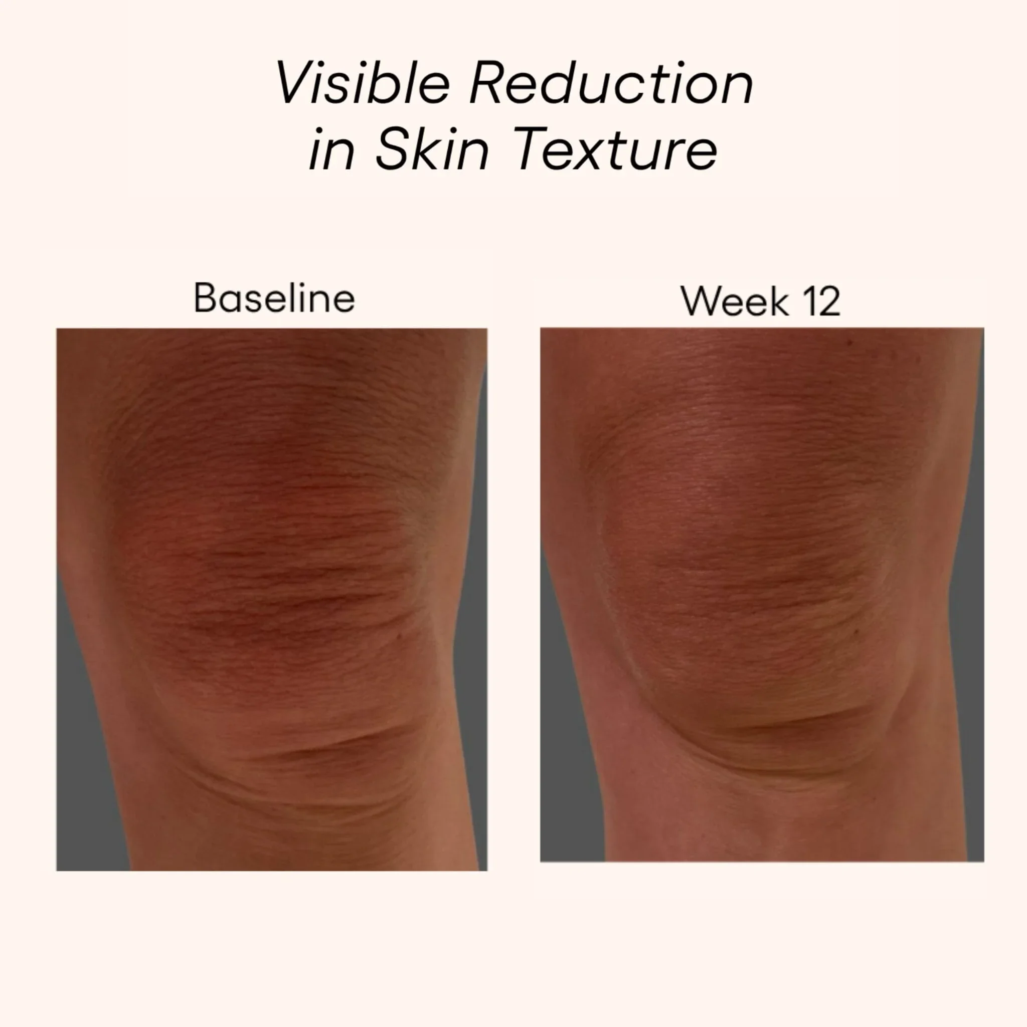 plated-body-serum-skin-texture-reduction-before-after.jpg.webp