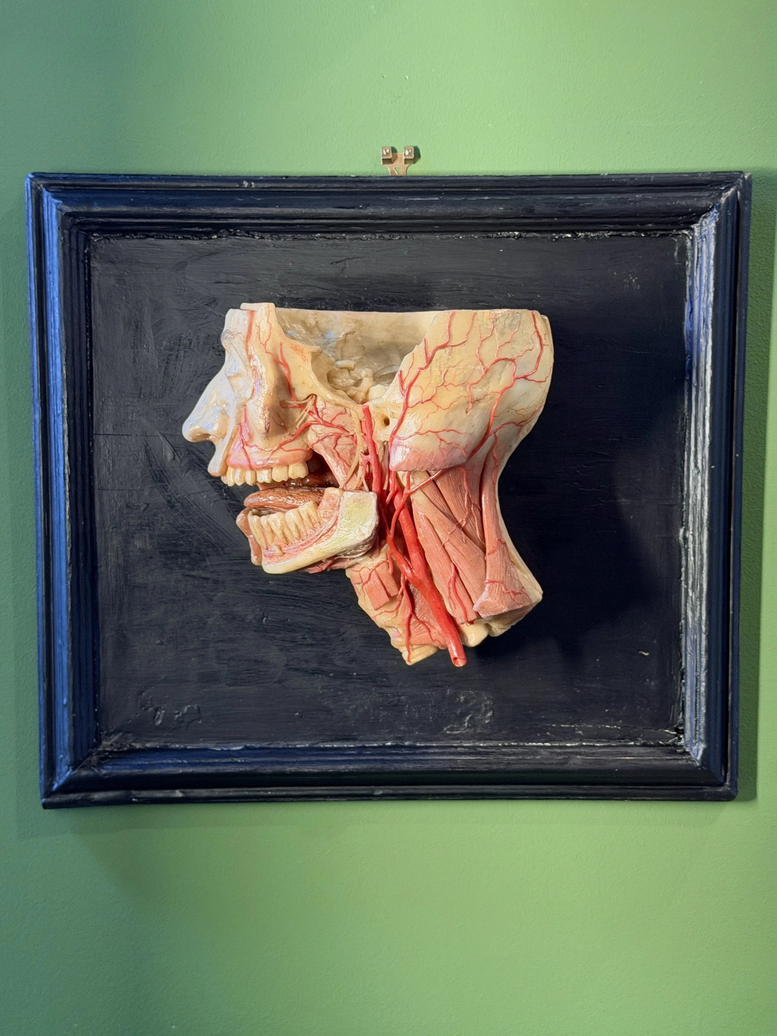 19th Century Anatomical Dissected Wax Head Model Mounted on Wooden Frame