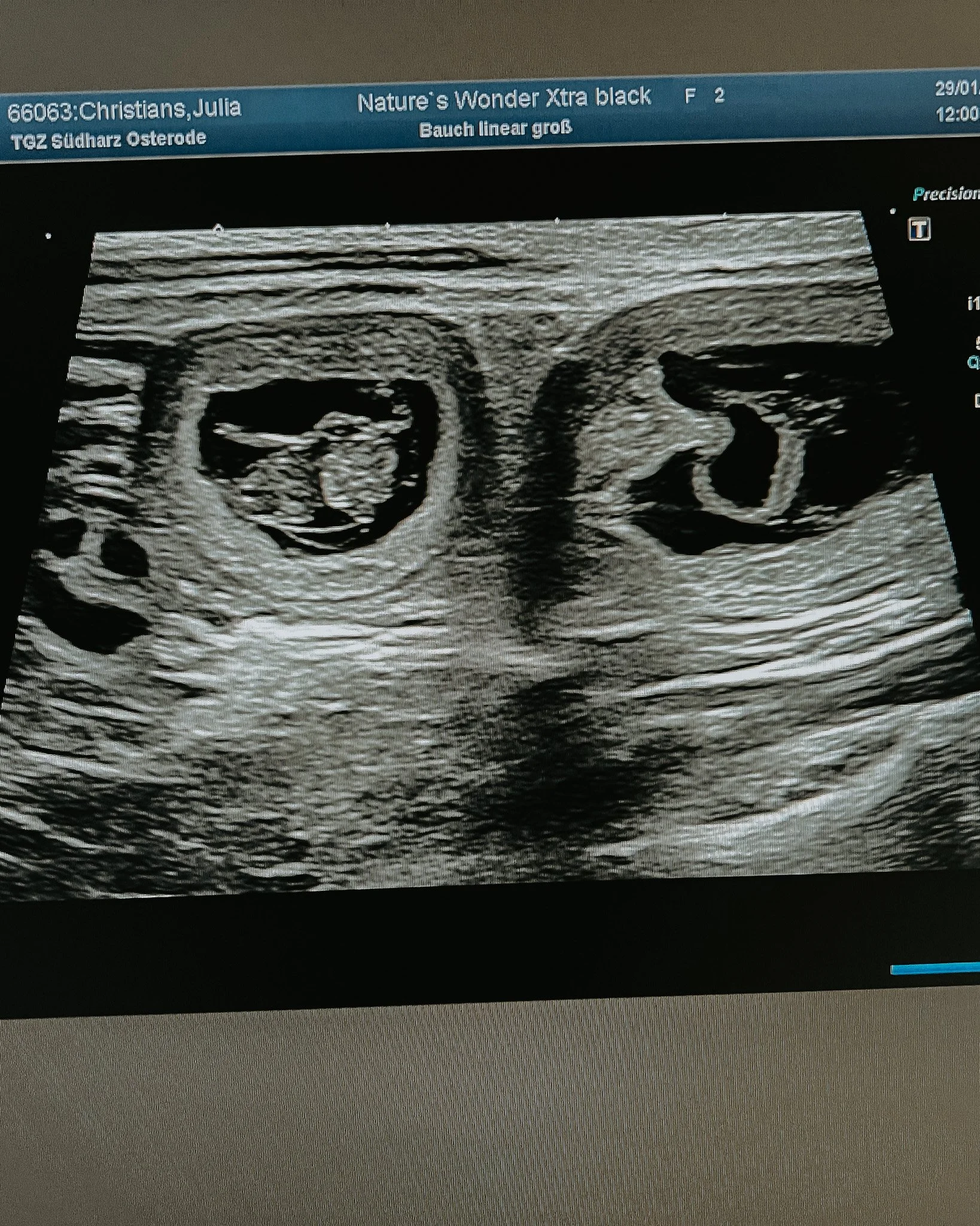 A-Wurf ist unterwegs