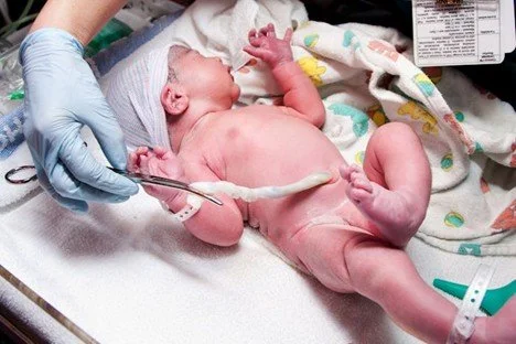 Baby's cord is held up before it's trimmed showing where the belly button will form.