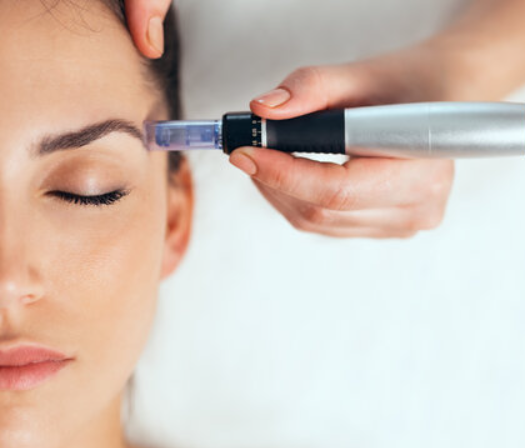 Professional Microneedling vs. At-Home Devices: What's the Difference?