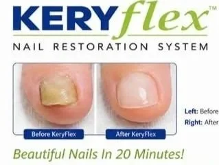 keryflex Nail Restoration