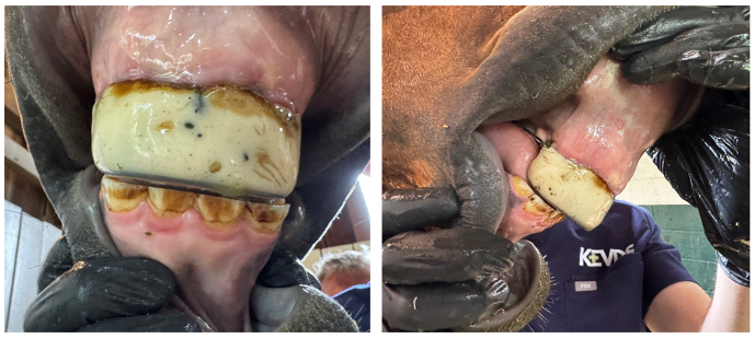 A functional orthodontic appliance from the front and side view