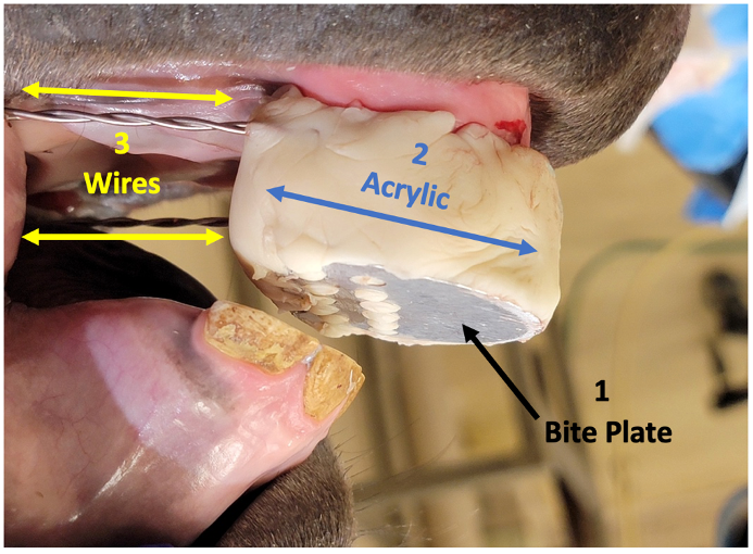 the three components of an orthodontic appliance