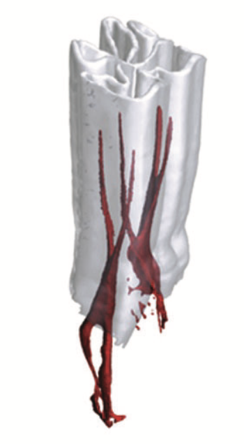 nerve and blood supply inside the equine cheek tooth