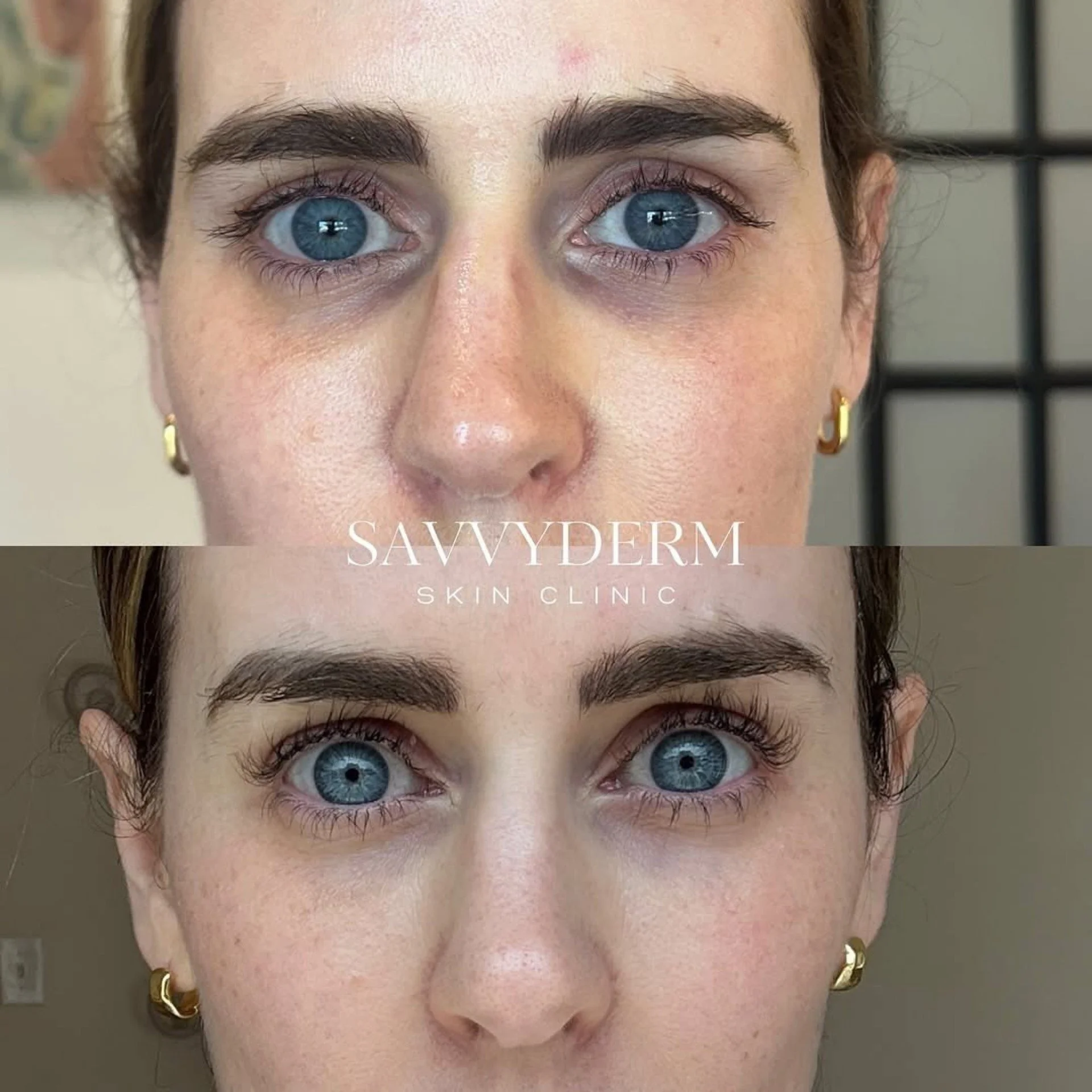 ERC - DERM.jpg