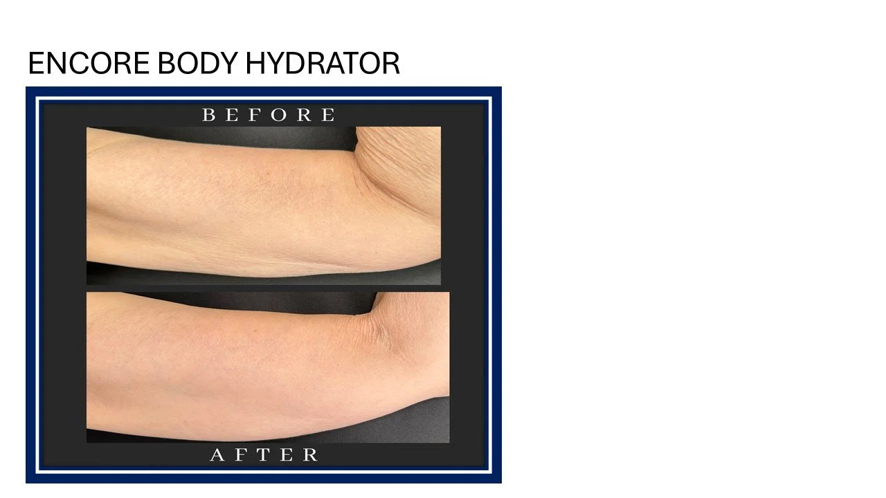 Slide42.JPG
