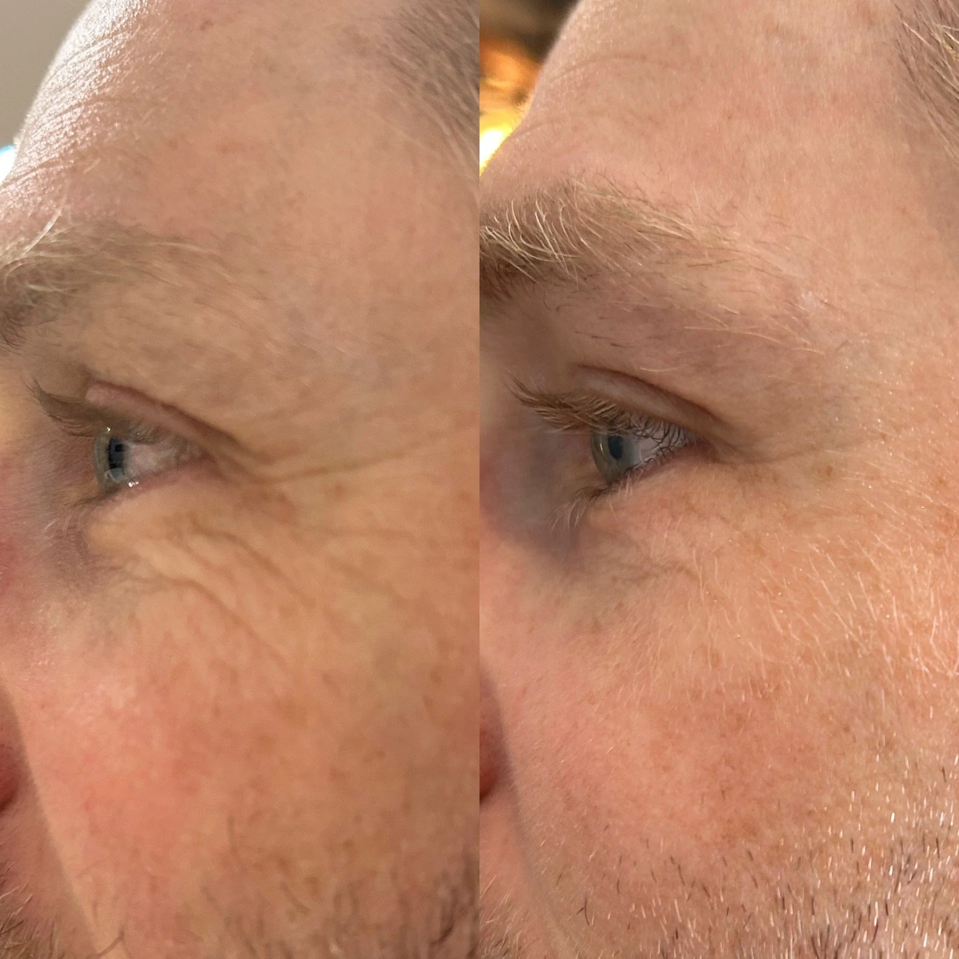 eye 2.jpg