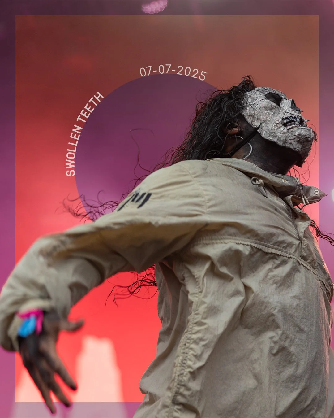 67 Swollen Teeth.jpg