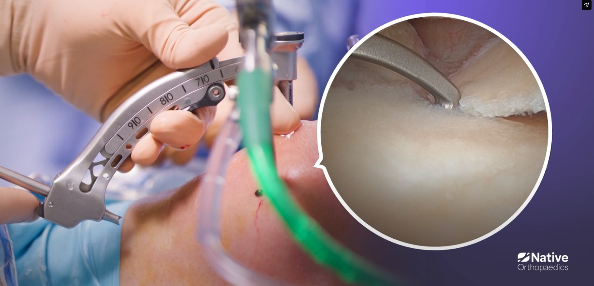 Native Root Step 2: Drilling with the RootFinder