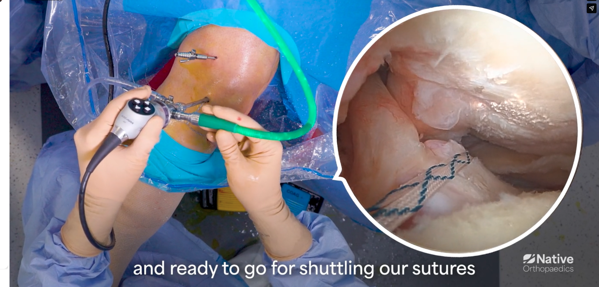 Native Root Step 3: Shuttle the Wire Loop