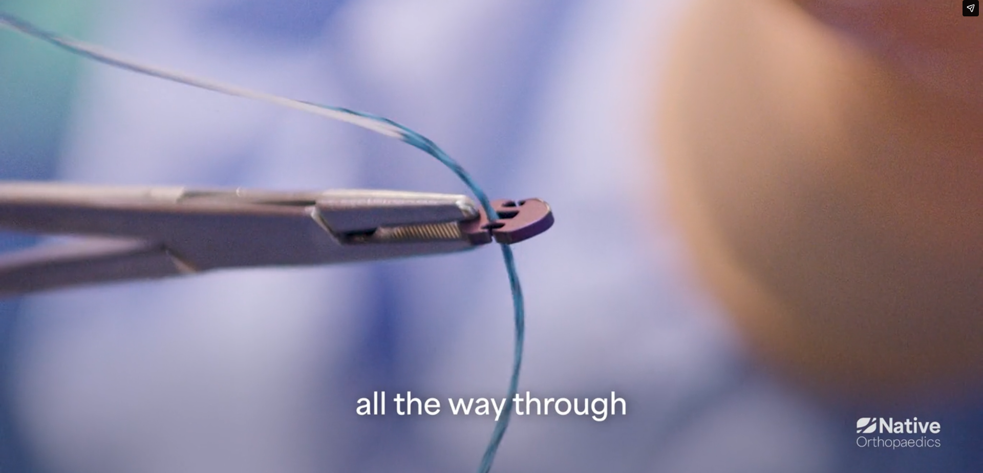 Native Root Step 7: Loading the No-Tie Button