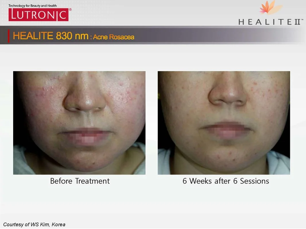 bfphotos-healiteii-global-20120412-page-04_orig.jpg