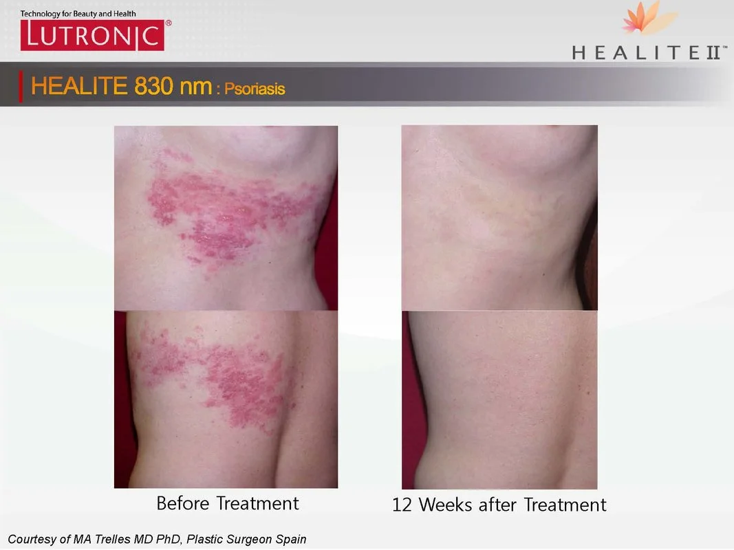 bfphotos-healiteii-global-20120412-page-05_orig.jpg