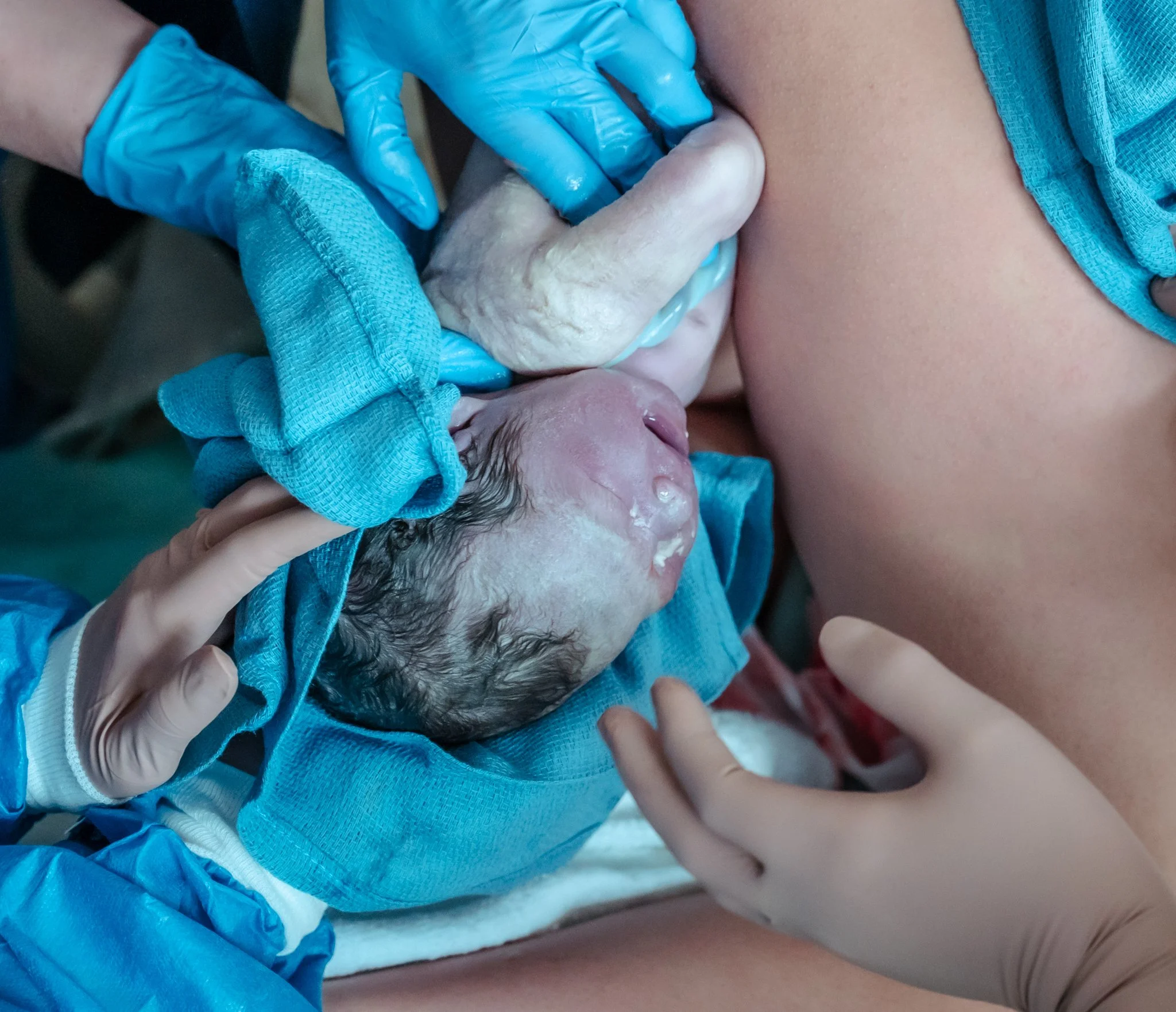 Capturing Life's First Moments: The Ultimate Guide to Columbia, MO Birth Photography