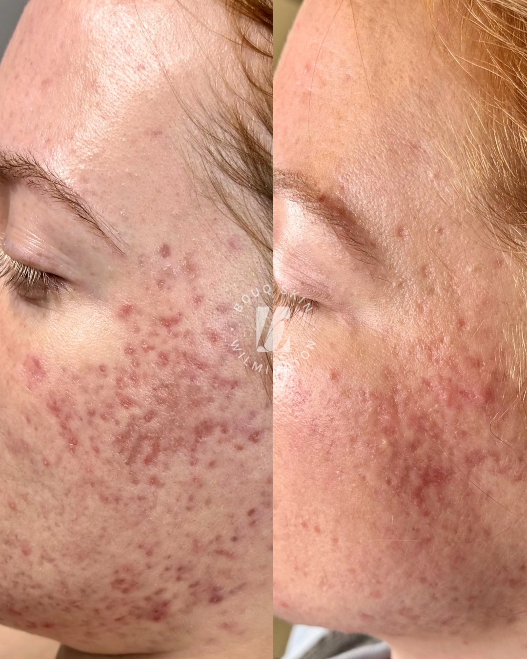 Copy of Copy of Copy of Copy of Copy of Untitled Design - 1.PNG