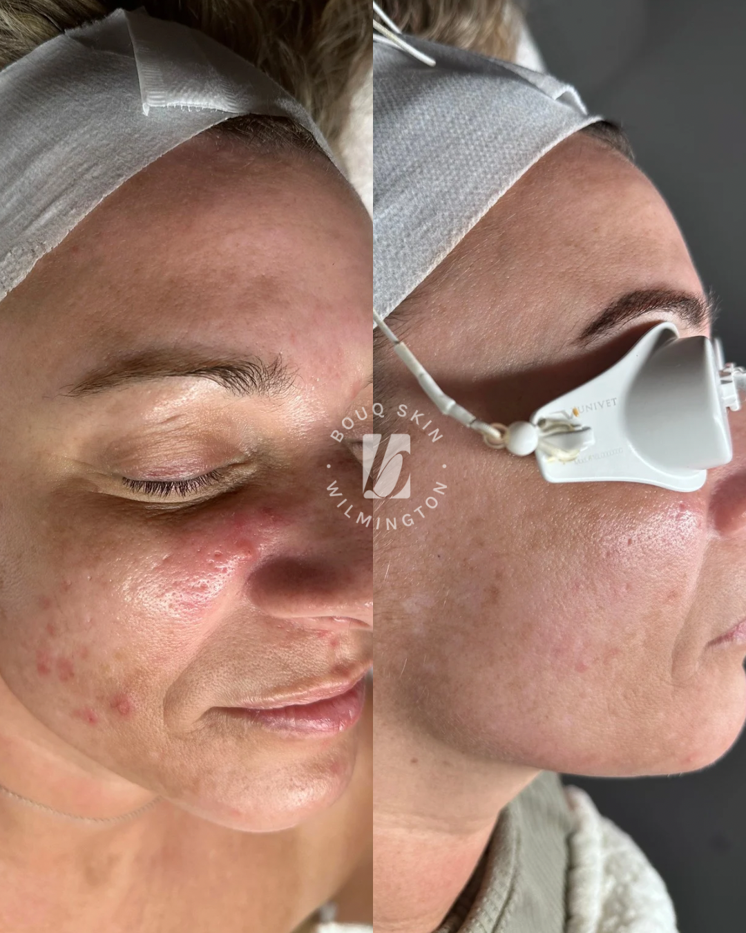 Copy of Untitled Design - 1.PNG