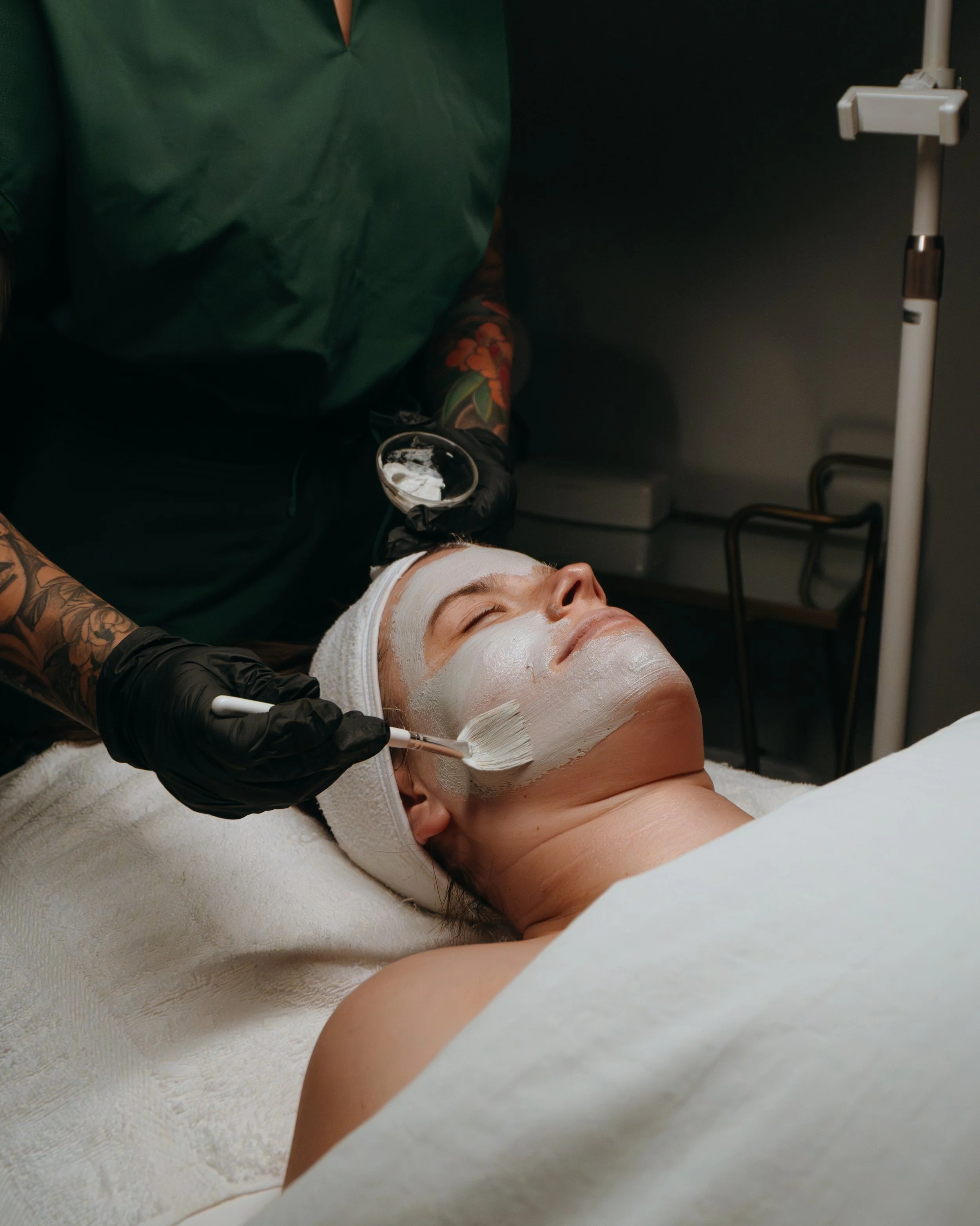 Struggling with Uneven Skin Tone? Here’s How Chemical Peels Help Hyperpigmentation