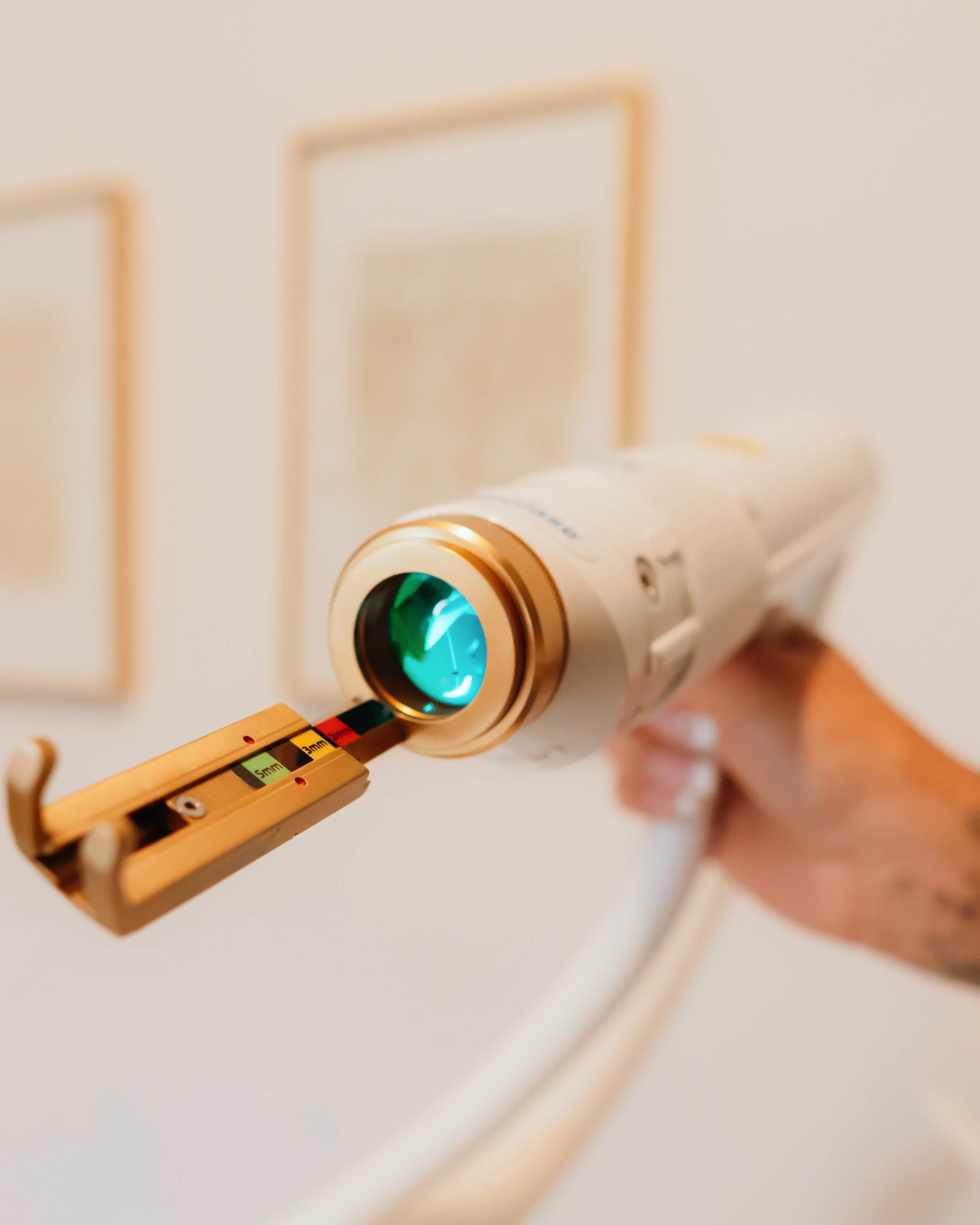 Clearer Skin with Aerolase: How the Neo Elite® Laser Transforms Acne