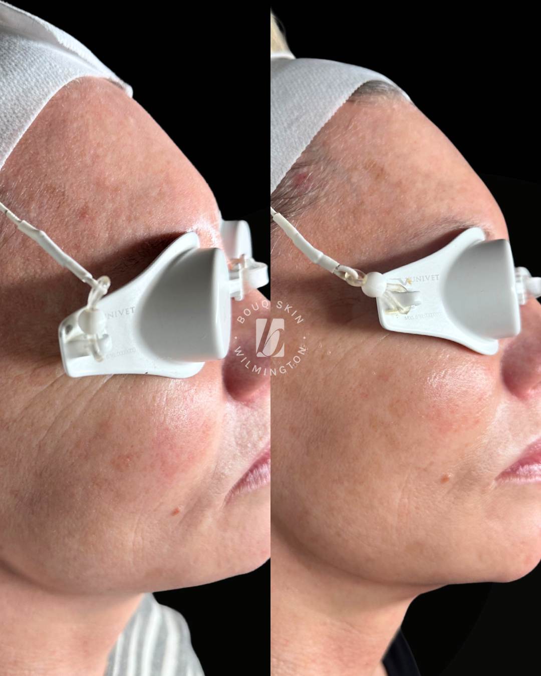 Untitled design - 1.PNG