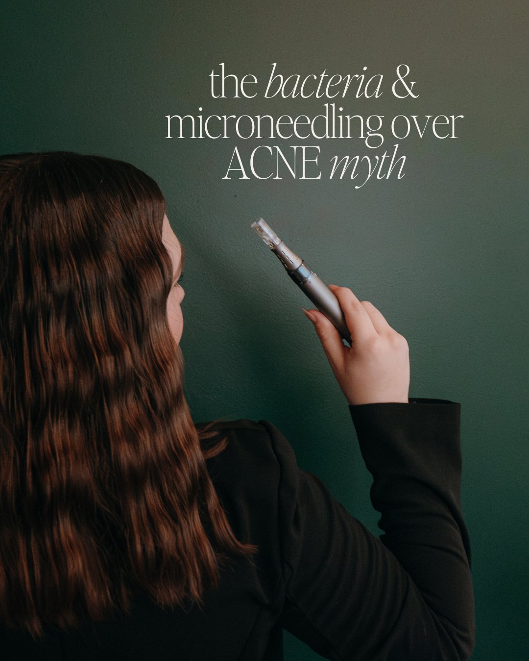Does Microneedling Make Acne Worse? The Truth About Treating Active Breakouts