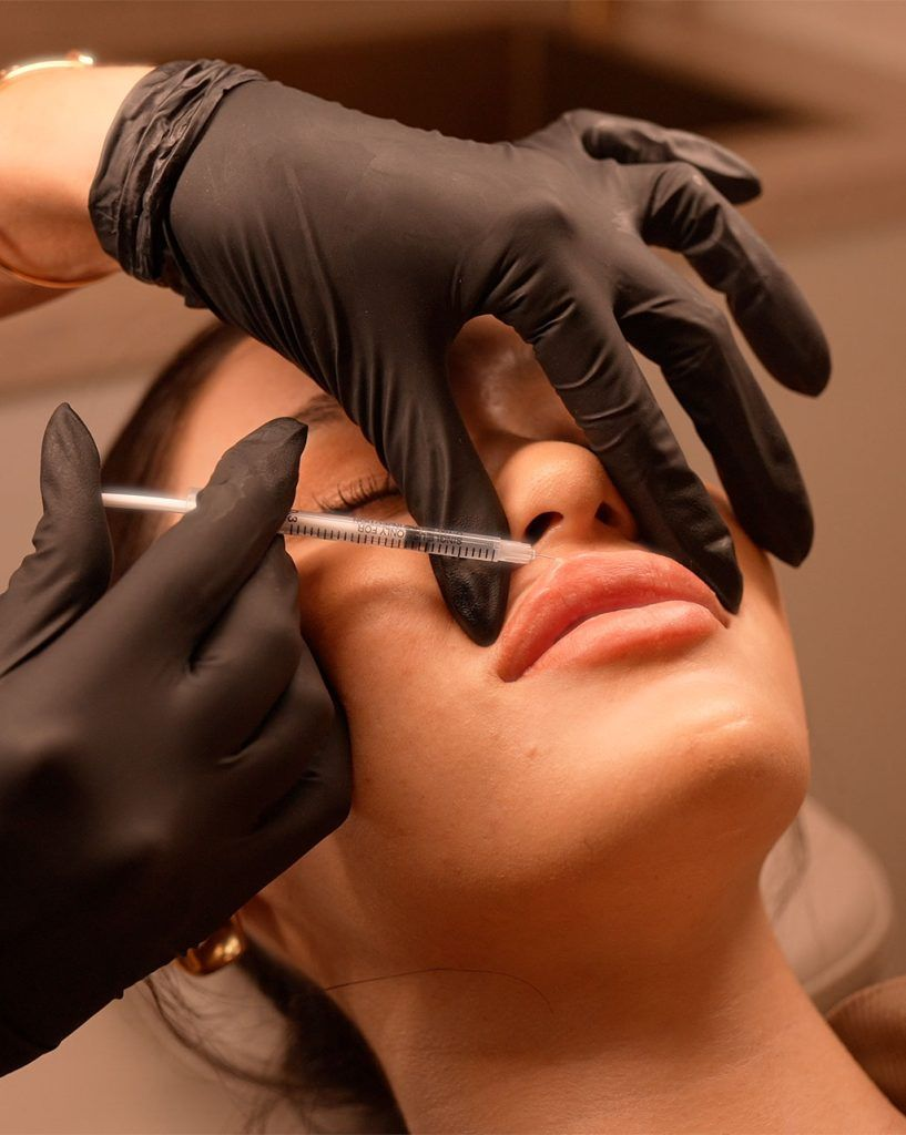 dermal fillers