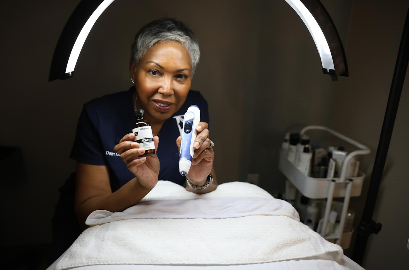 Microneedling Gilbert, AZ