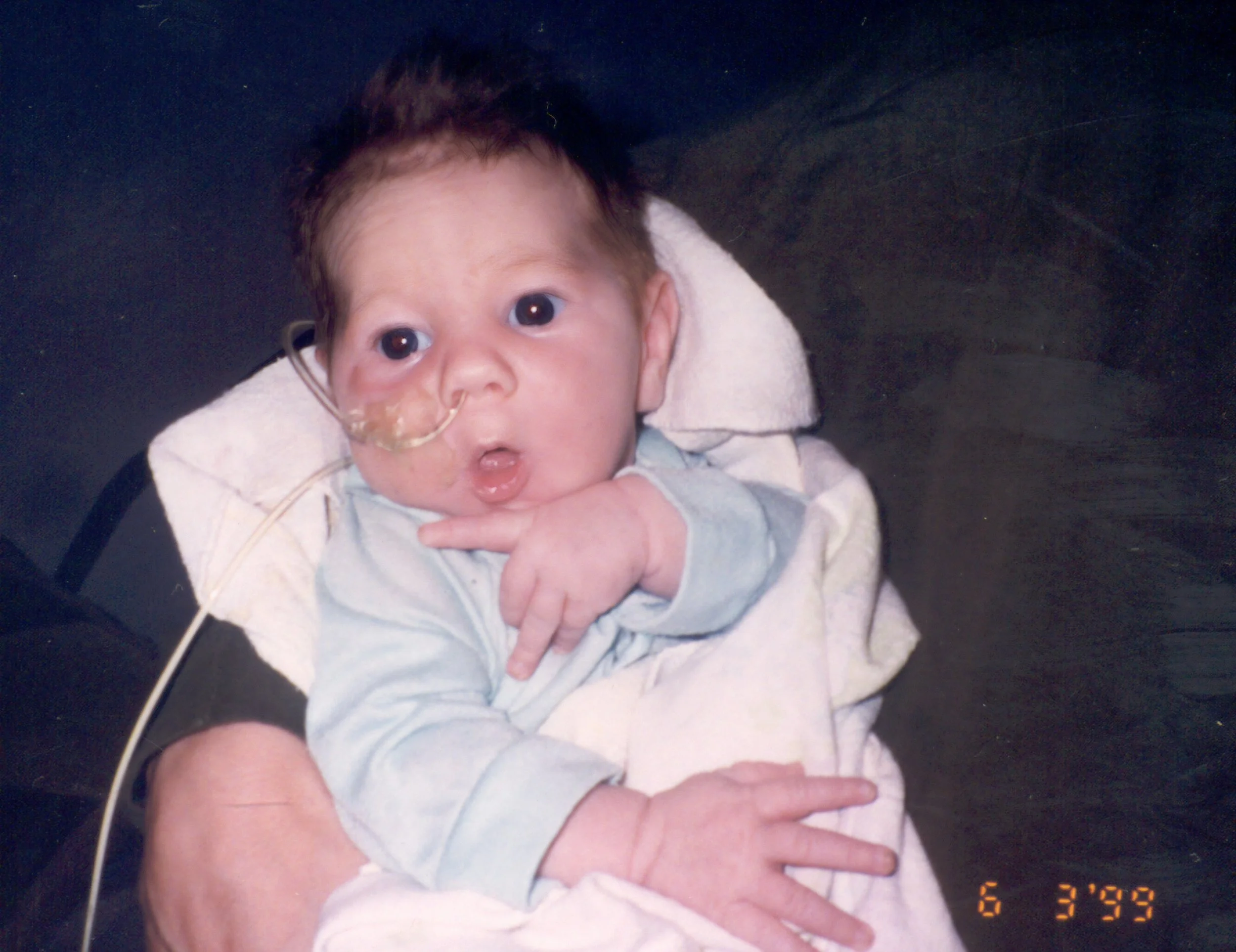 1999 waiting for a G-tube
