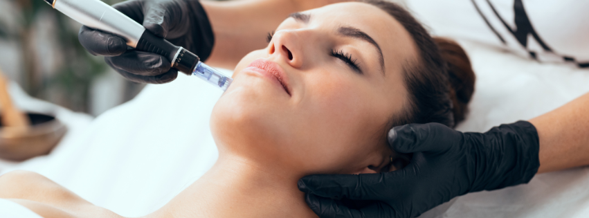 Brightening Microneedling in Rio Rancho | M Spa & Salon.png