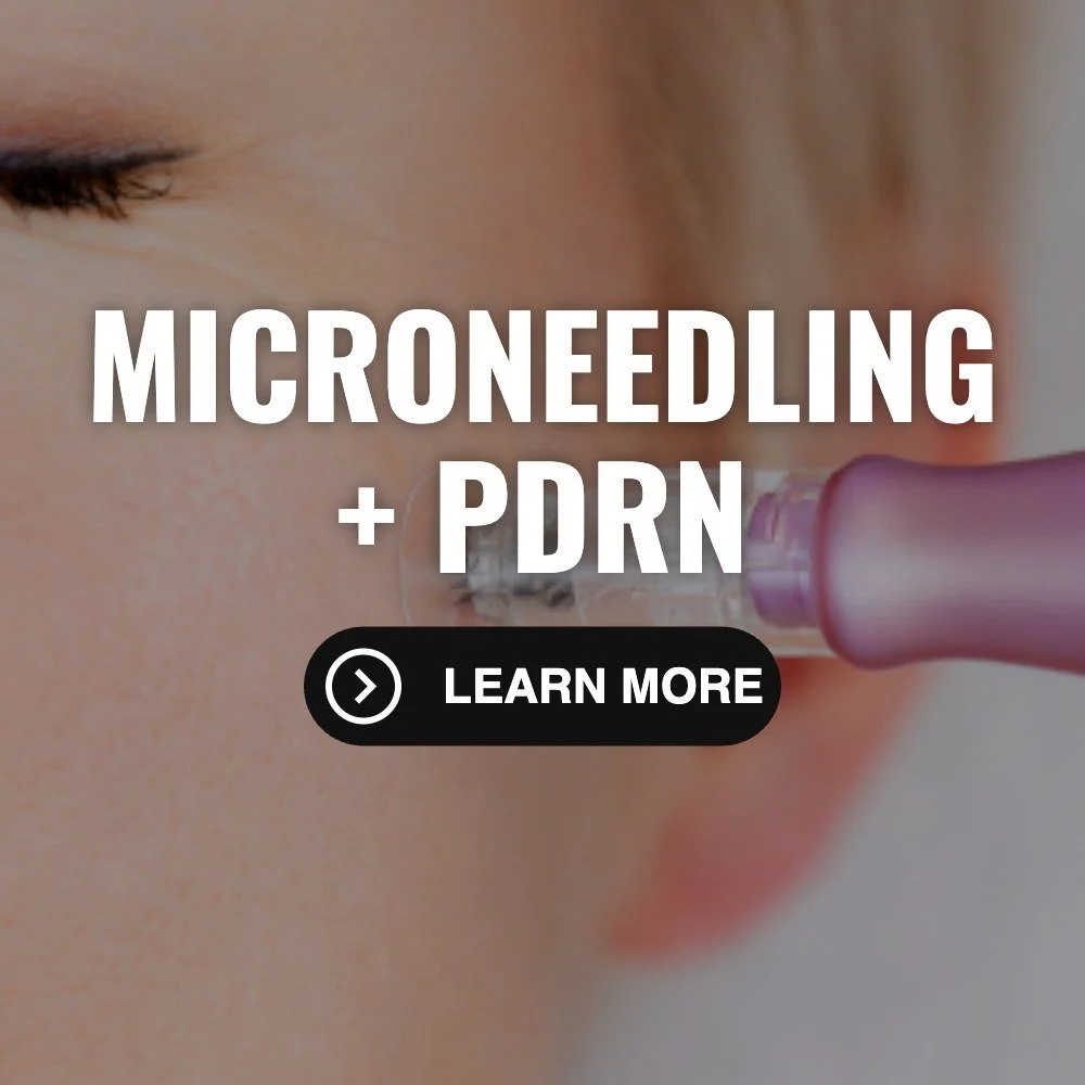 Microneedling with PDRN for smoother, firmer skin at M Spa Clinical Aesthetics in Rio Rancho NM