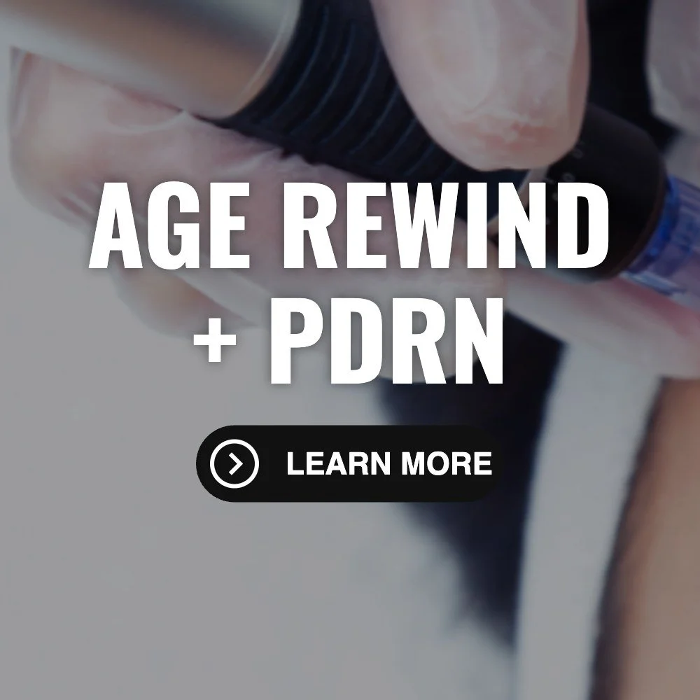 Age Rewind microneedling with PDRN at M Spa Clinical Aesthetics in Rio Rancho NM