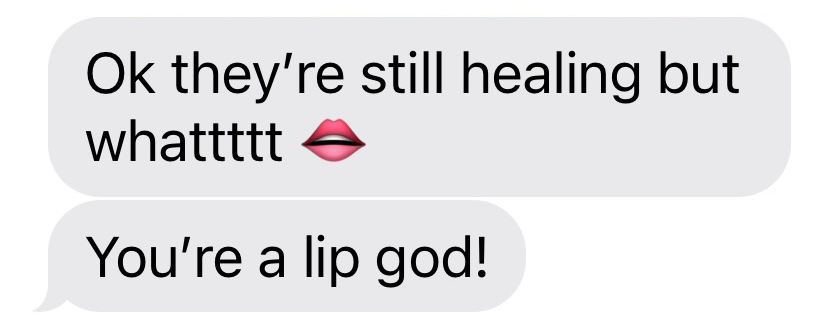 natural lip filler